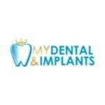 My Dental Implants